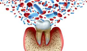 Oral Probiotics & Inflammation: Reducing Systemic Inflammation Through Oral Health