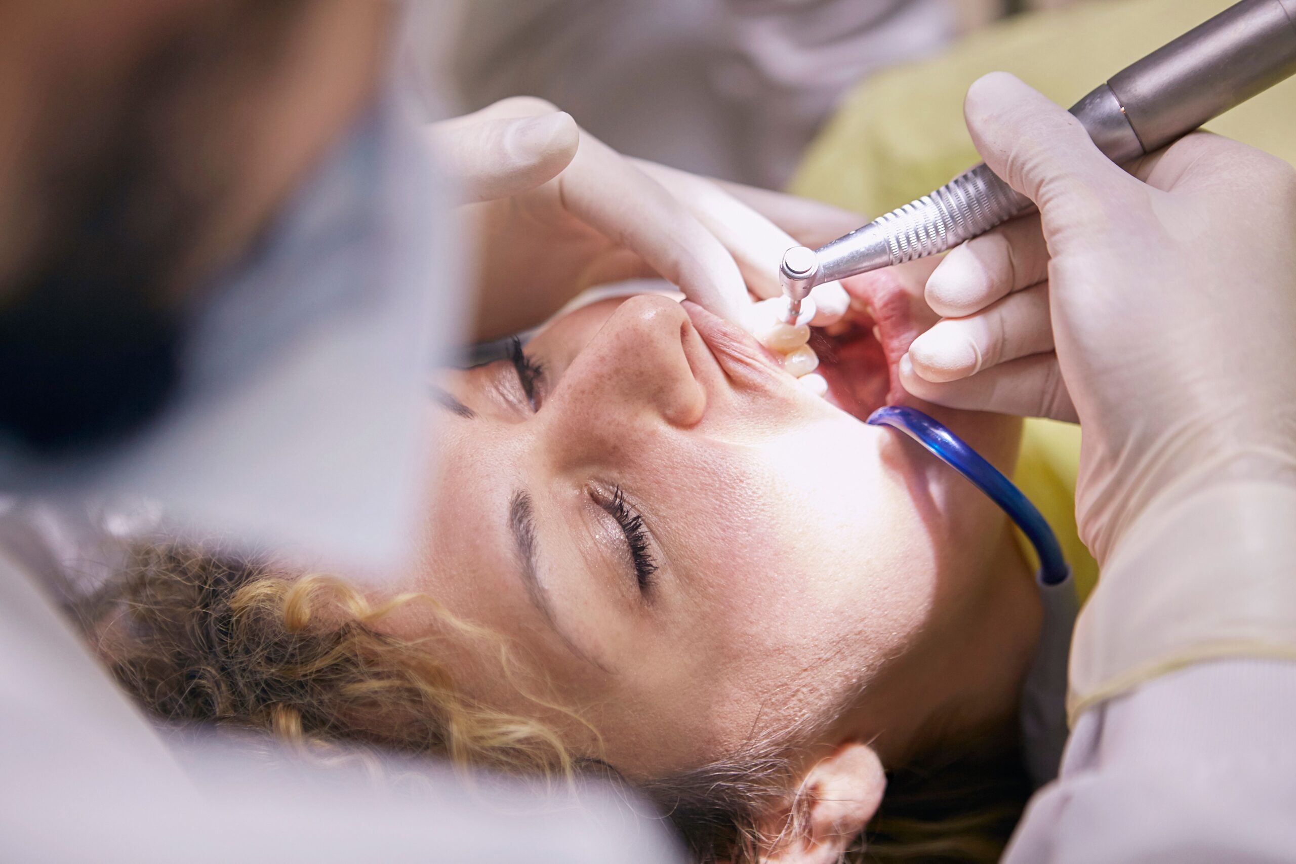 Dental hygienist scaling a patient's teeth during a professional cleaning appointment